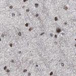 SFRS15 Antibody in Immunohistochemistry (IHC)