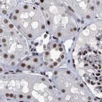 SFRS15 Antibody in Immunohistochemistry (IHC)