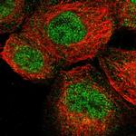 ENTPD8 Polyclonal Antibody