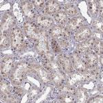 ENTPD8 Antibody in Immunohistochemistry (Paraffin) (IHC (P))