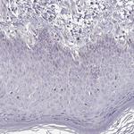 ENTPD8 Antibody in Immunohistochemistry (Paraffin) (IHC (P))