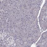 ENTPD8 Antibody in Immunohistochemistry (IHC)
