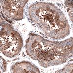 OSBP2 Polyclonal Antibody