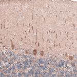 OSBP2 Antibody in Immunohistochemistry (IHC)