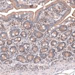 OSBP2 Antibody in Immunohistochemistry (IHC)