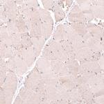 OSBP2 Antibody in Immunohistochemistry (IHC)