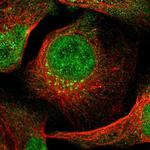 ING2 Polyclonal Antibody