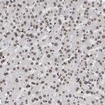 ING2 Antibody in Immunohistochemistry (Paraffin) (IHC (P))