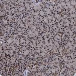 ING2 Antibody in Immunohistochemistry (Paraffin) (IHC (P))