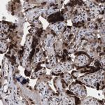 ING2 Antibody in Immunohistochemistry (Paraffin) (IHC (P))