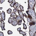 SVEP1 Polyclonal Antibody