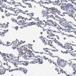 SVEP1 Antibody in Immunohistochemistry (IHC)