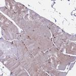 ZBTB5 Antibody in Immunohistochemistry (Paraffin) (IHC (P))