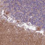 CREBZF Polyclonal Antibody