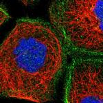 LRCH1 Polyclonal Antibody