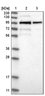 LRCH1 Antibody in Western Blot (WB)