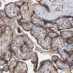 LRCH1 Antibody in Immunohistochemistry (IHC)