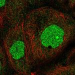 ZNF791 Polyclonal Antibody