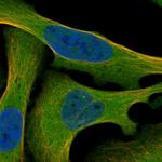 MEKK2 Polyclonal Antibody