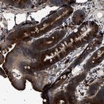 TOP1MT Polyclonal Antibody