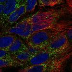 TPK1 Polyclonal Antibody