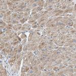 TPK1 Antibody in Immunohistochemistry (Paraffin) (IHC (P))
