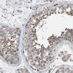 TPK1 Antibody in Immunohistochemistry (Paraffin) (IHC (P))