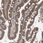 MAK10 Antibody in Immunohistochemistry (Paraffin) (IHC (P))