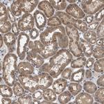 MAK10 Antibody in Immunohistochemistry (Paraffin) (IHC (P))