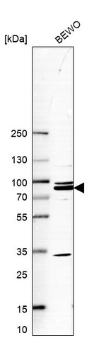 MAK10 Antibody in Western Blot (WB)