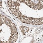 MAK10 Antibody in Immunohistochemistry (IHC)