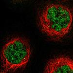 ZBTB10 Polyclonal Antibody