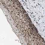 ZBTB10 Antibody in Immunohistochemistry (Paraffin) (IHC (P))