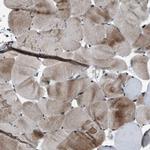 ZBTB10 Antibody in Immunohistochemistry (IHC)