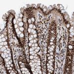 SMCR8 Antibody in Immunohistochemistry (IHC)