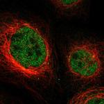 NPLOC4 Polyclonal Antibody