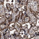 NPLOC4 Antibody in Immunohistochemistry (Paraffin) (IHC (P))