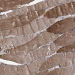 NPLOC4 Antibody in Immunohistochemistry (Paraffin) (IHC (P))