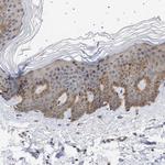 NPLOC4 Antibody in Immunohistochemistry (Paraffin) (IHC (P))