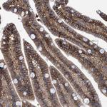 SLC43A2 Antibody in Immunohistochemistry (Paraffin) (IHC (P))