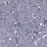 SLC43A2 Polyclonal Antibody