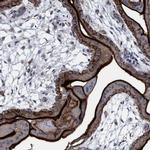 SLC43A2 Antibody in Immunohistochemistry (IHC)
