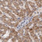 SCO1 Antibody in Immunohistochemistry (IHC)