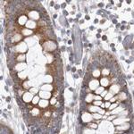SCO1 Antibody in Immunohistochemistry (IHC)