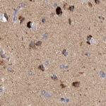 SCO1 Antibody in Immunohistochemistry (IHC)