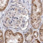 SCO1 Antibody in Immunohistochemistry (IHC)