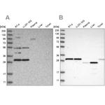 SCO1 Antibody in Western Blot (WB)