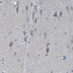 ANKFN1 Antibody in Immunohistochemistry (Paraffin) (IHC (P))
