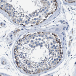 ANKFN1 Antibody in Immunohistochemistry (Paraffin) (IHC (P))