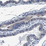 ANKFN1 Antibody in Immunohistochemistry (IHC)